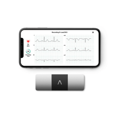 AliveCor KardiaMobile 6L, FDA-Cleared, Wireless 6-Lead EKG